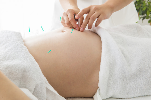 妊婦さんの鍼灸治療
