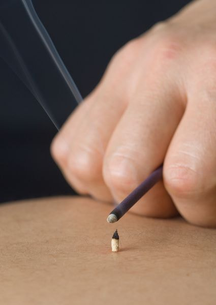 逆子治療